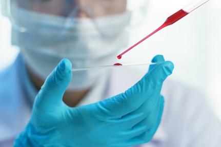 Noticia: Un nuevo hallazgo teoriza acerca de que el coronavirus afecta menos al grupo sanguíneo O, mientras que afecta más al grupo A