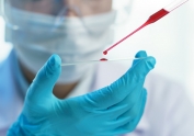 Un nuevo hallazgo teoriza acerca de que el coronavirus afecta menos al grupo sanguíneo O, mientras que afecta más al grupo A
